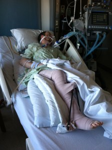 Jeremy in ICU, February 17, 2012.